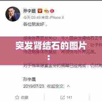 突发肾结石的图片: