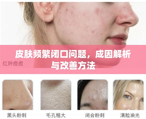 皮肤频繁闭口问题,成因解析与改善方法