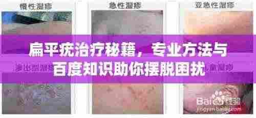 扁平疣治疗秘籍，专业方法与百度知识助你摆脱困扰